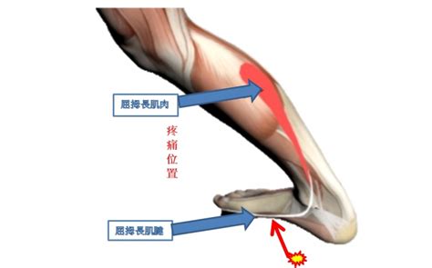 小傷|小傷(こきず)とは？ 意味や使い方